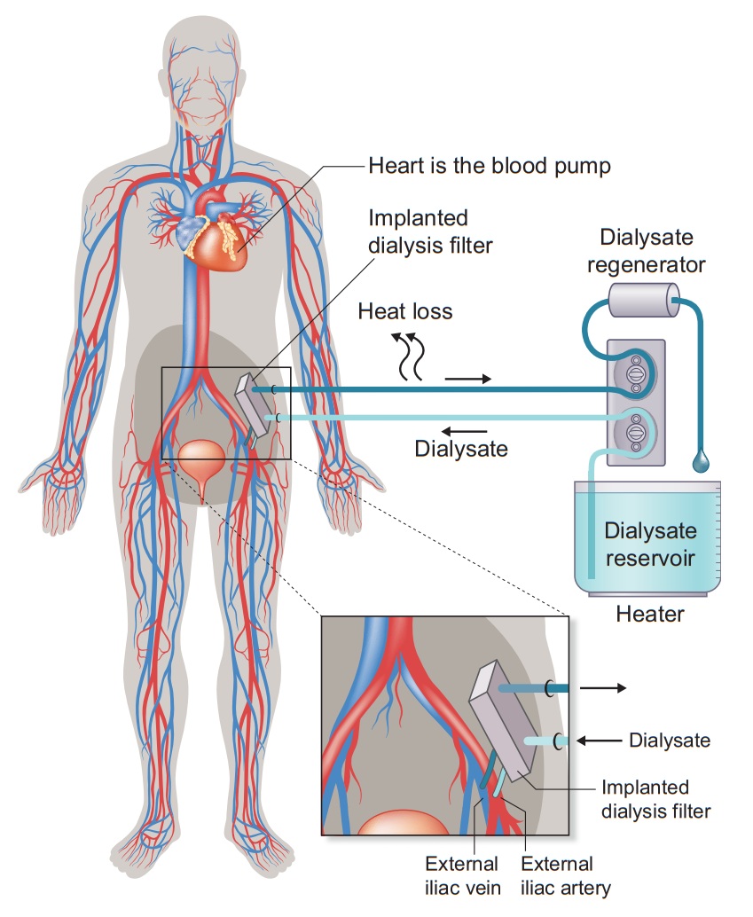 KIDNEW Booster Principle Diagram